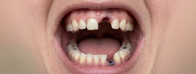 Gemini Generated Image erqtfcerqtfcerqt