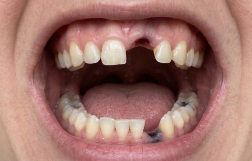 Gemini Generated Image erqtfcerqtfcerqt